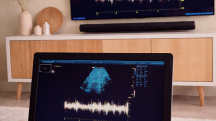 Pretecho Wonderbaarlijk Afbeelding 1